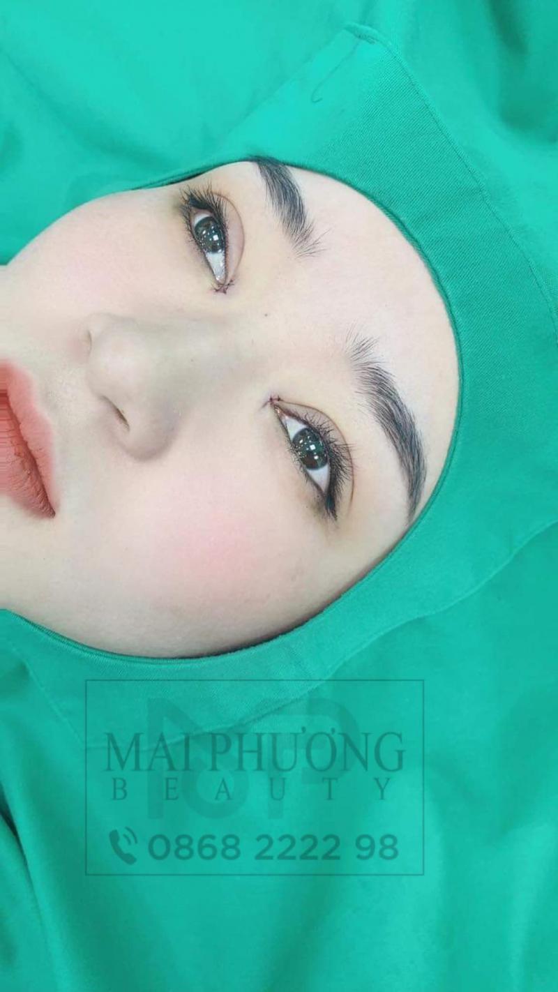 Thẩm Mỹ Mai Phương