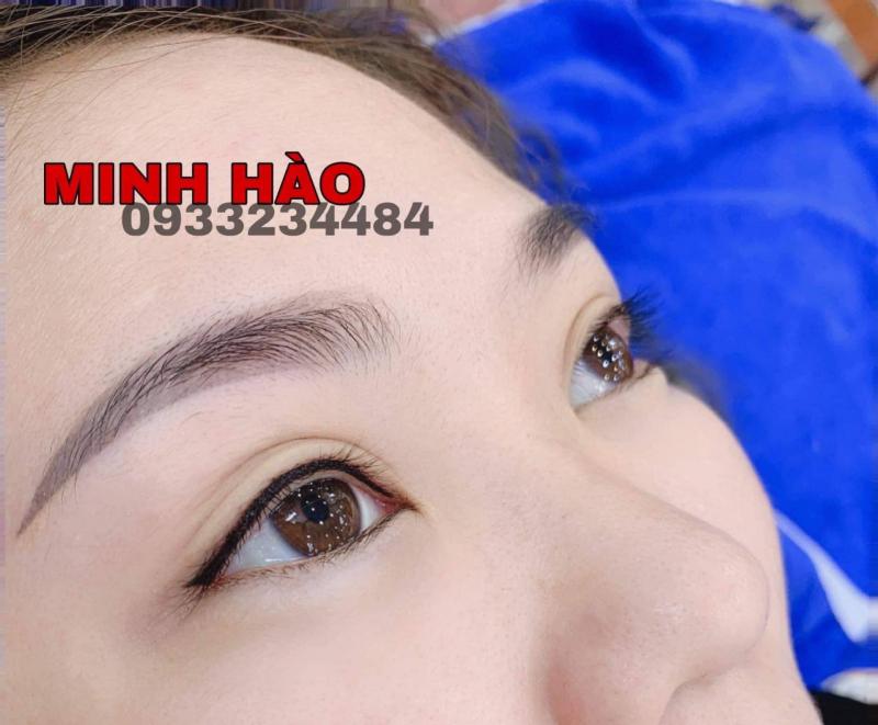 Thẩm mỹ Minh Hào