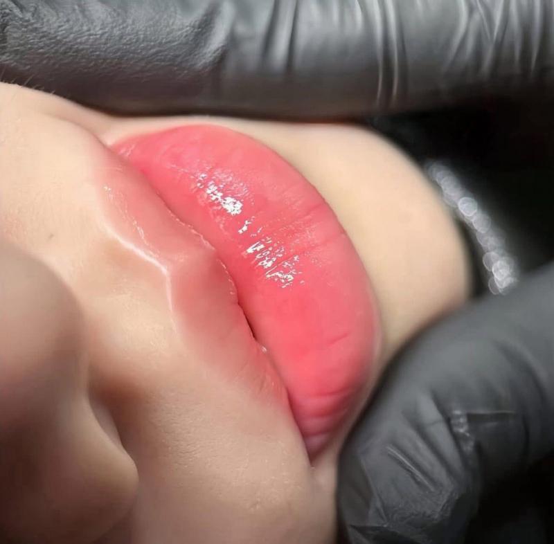 Thẩm mỹ Ngọc Hiển