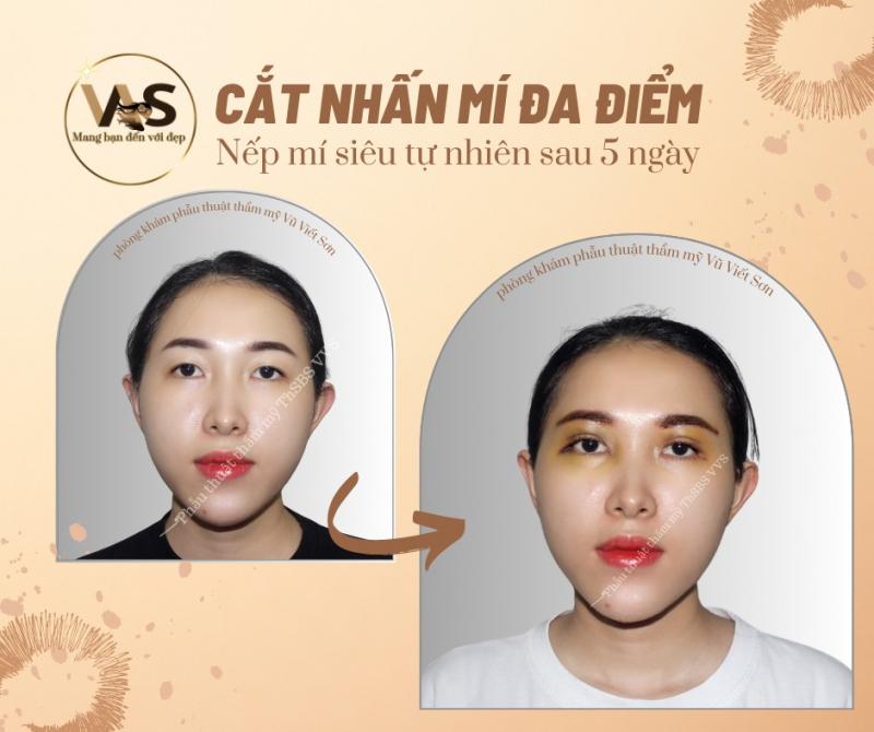 Thẩm Mỹ Nha Trang - VVS Cosmetic Surgery