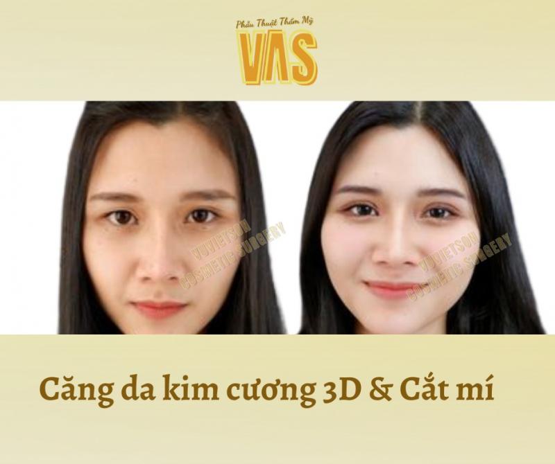 Thẩm Mỹ Nha Trang - VVS Cosmetic Surgery