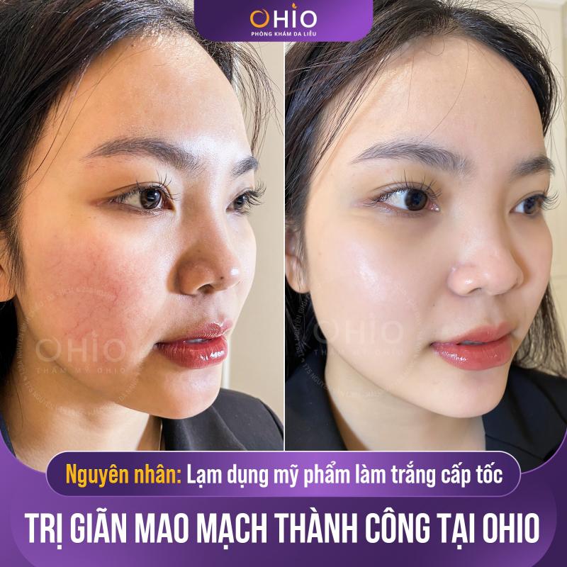 Thẩm mỹ OHIO