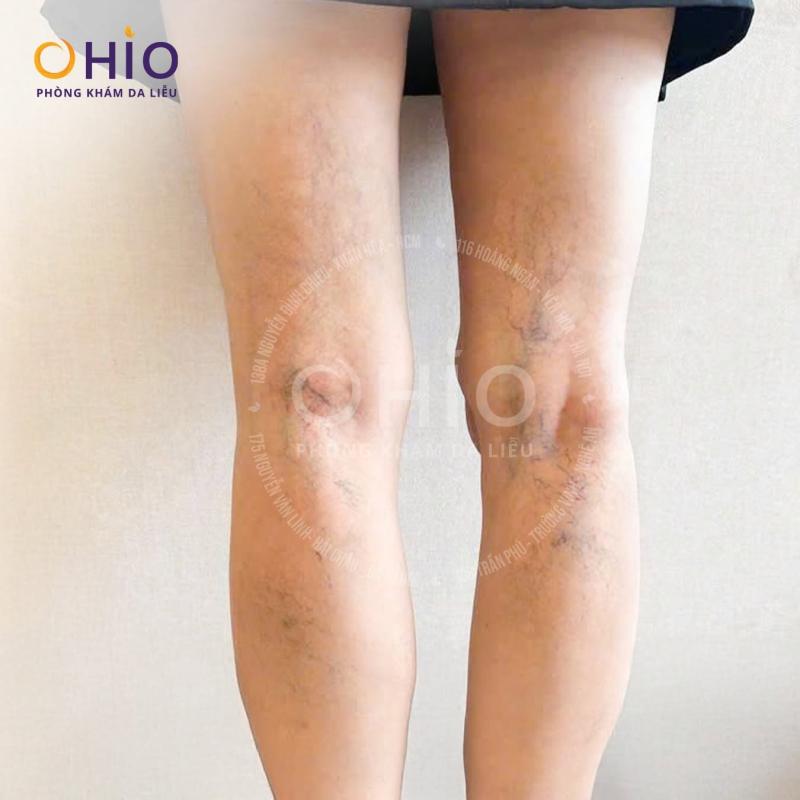 Thẩm mỹ OHIO