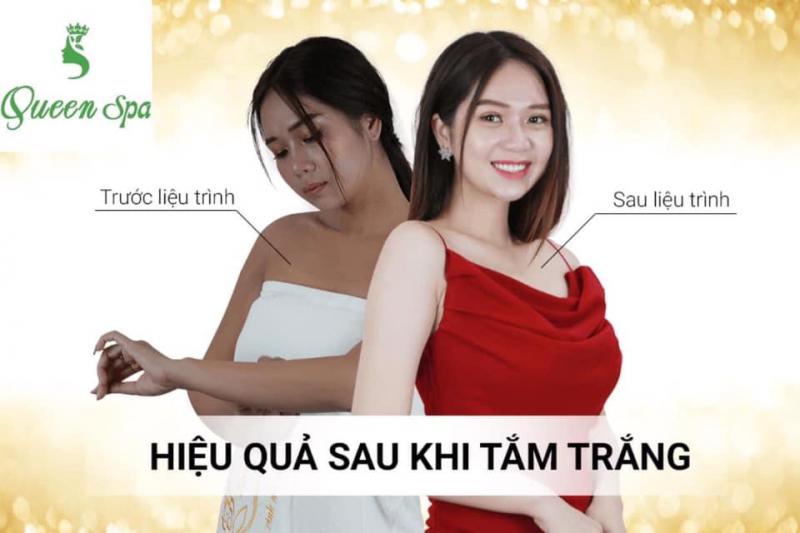 Thẩm Mỹ Queen Spa