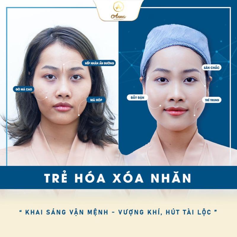 Thẩm Mỹ Quốc Tế ANNA