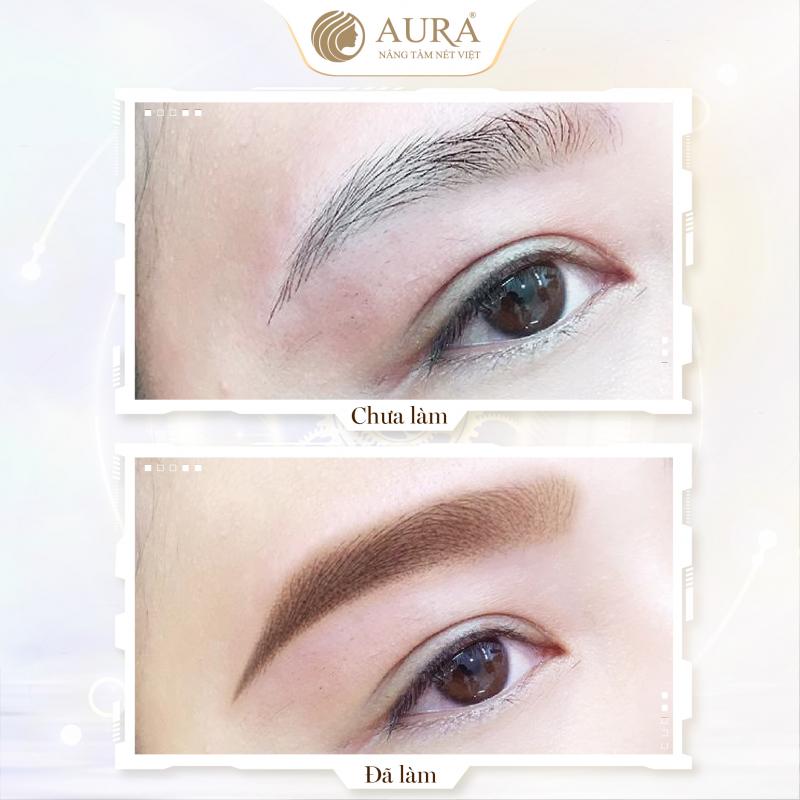 Thẩm Mỹ Quốc Tế Aura - Cần Thơ