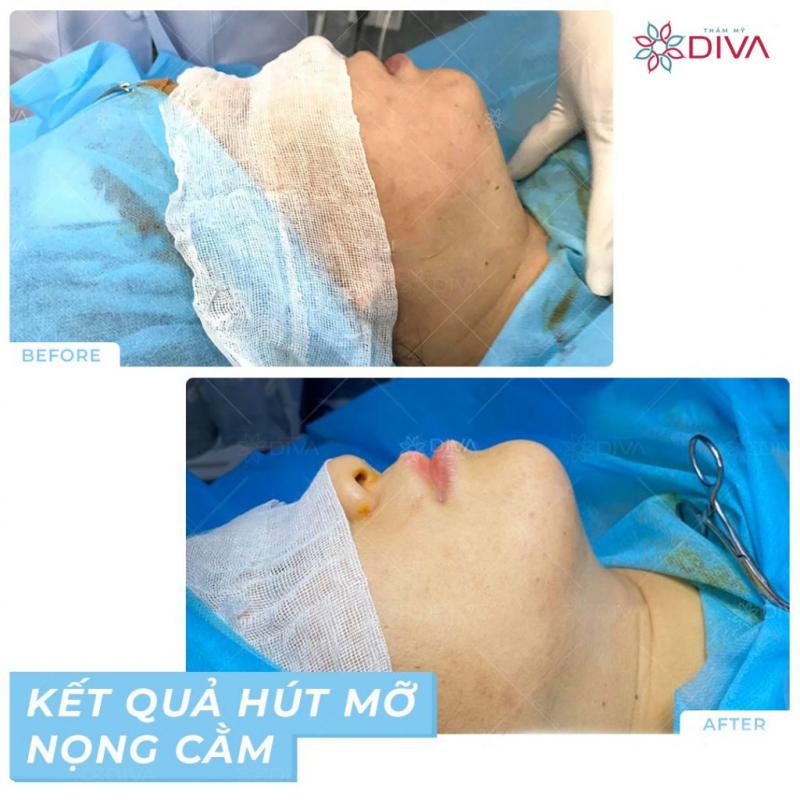 Thẩm Mỹ Quốc Tế Diva