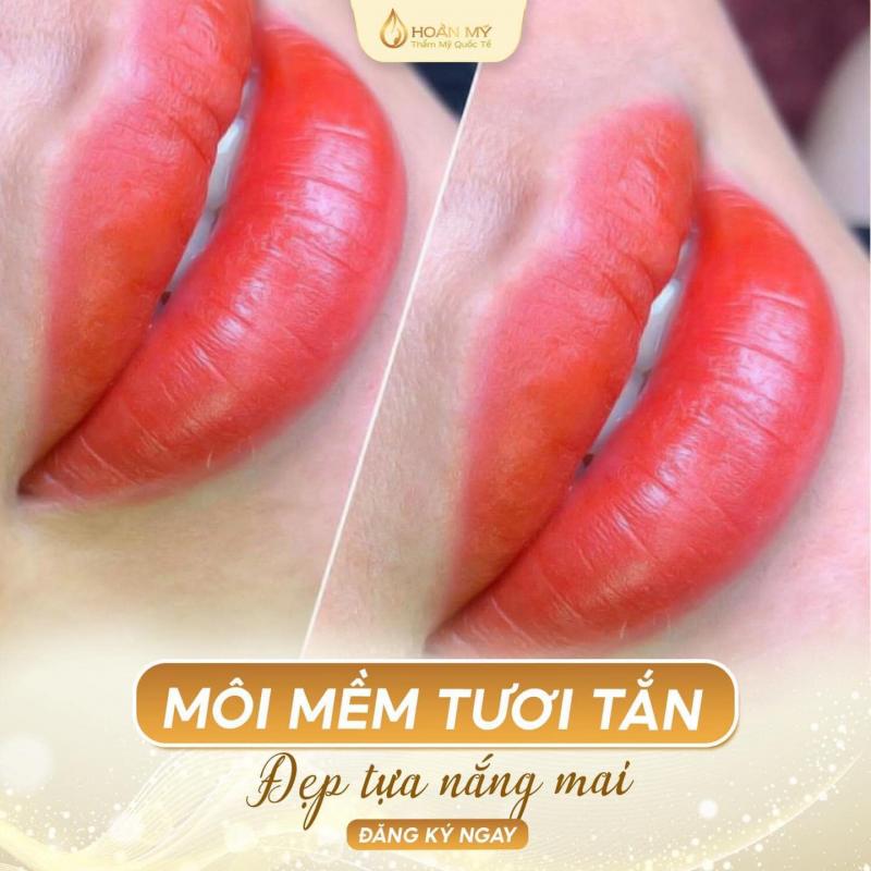 Thẩm Mỹ Quốc Tế Hoàn Mỹ