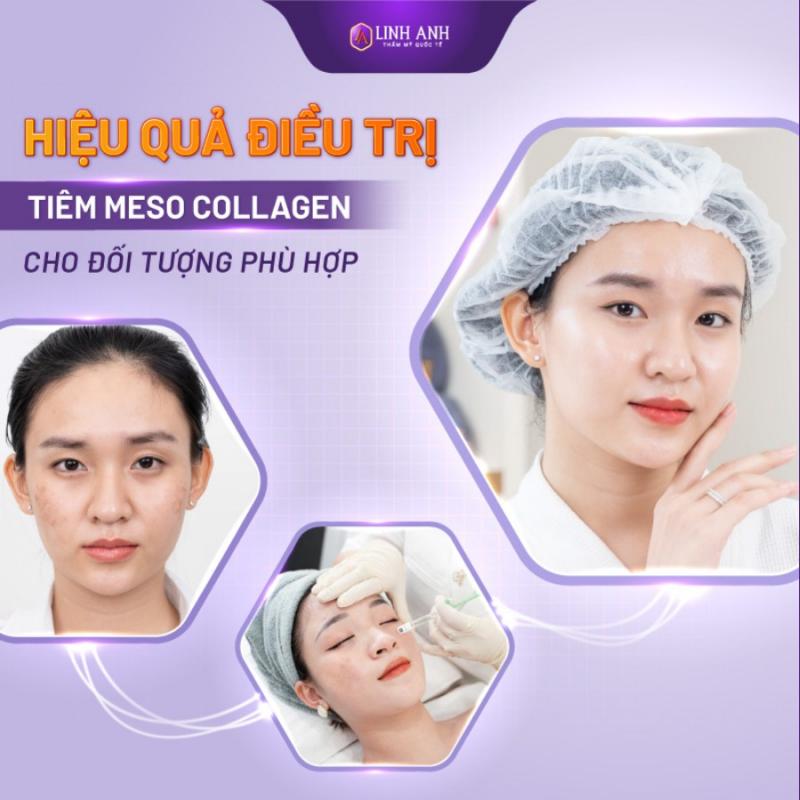 Thẩm mỹ Quốc tế Linh Anh