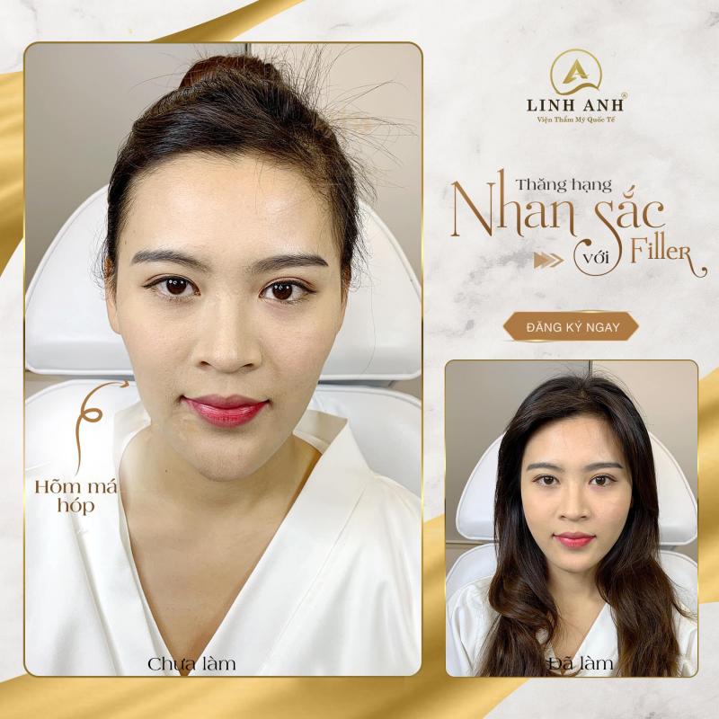 Thẩm mỹ Quốc tế Linh Anh - Phú Quốc