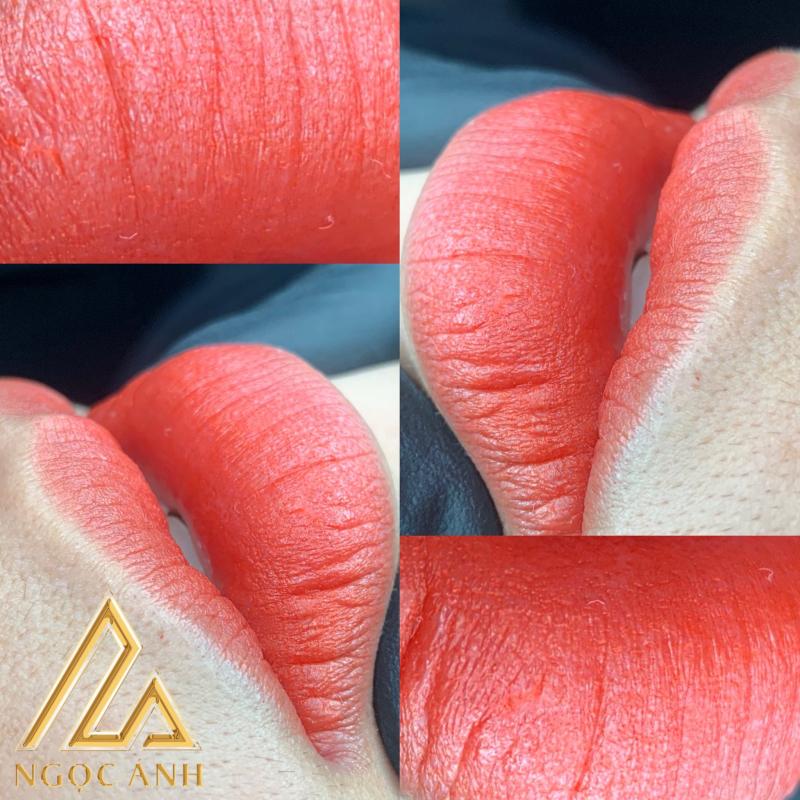 Thẩm Mỹ Quốc Tế Ngọc Ánh