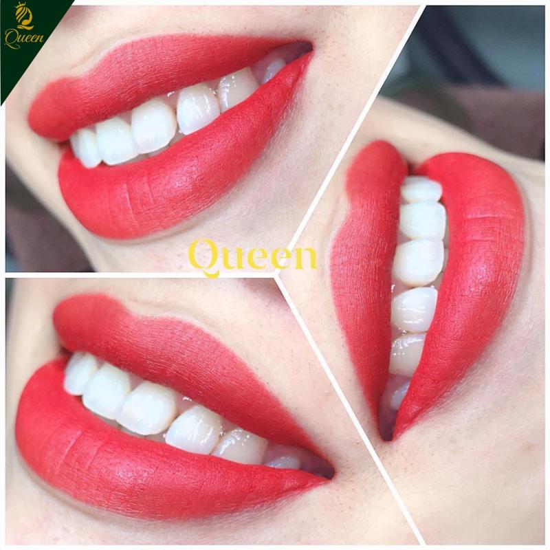 Thẩm Mỹ Quốc Tế Queen Hà Tĩnh