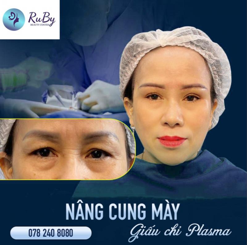 Thẩm Mỹ Quốc Tế RuBy Beauty Center