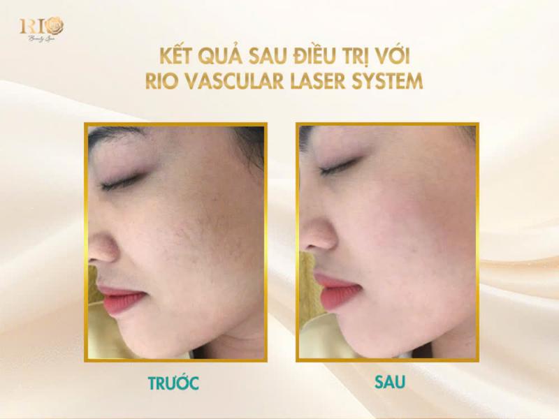 Thẩm mỹ Rio Beauty Clinic