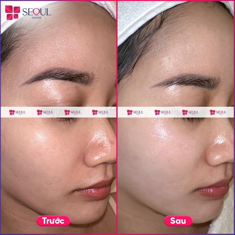 Thẩm Mỹ Seoul Center - Hóc Môn