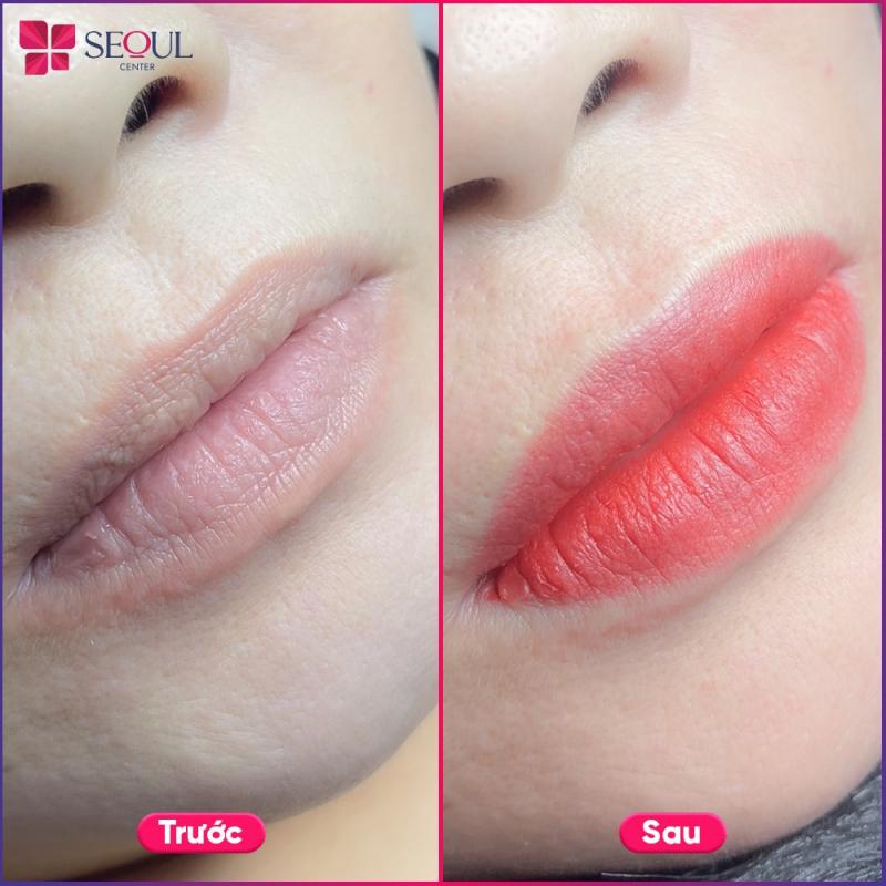 Thẩm Mỹ Seoul Center - Hóc Môn