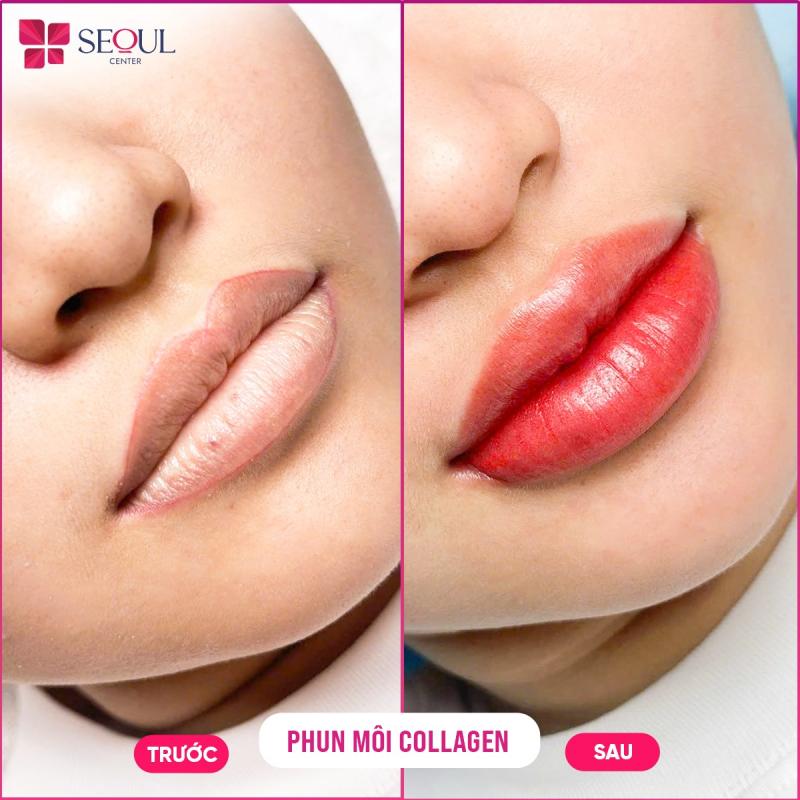 Thẩm Mỹ Seoul Center Long Khánh - Đồng Nai