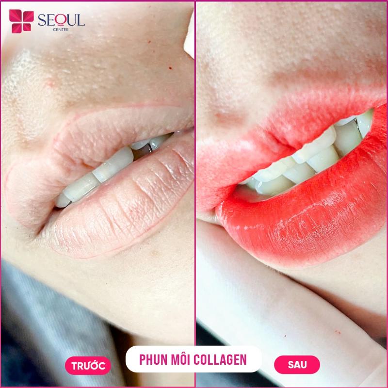 Thẩm Mỹ Seoul Center Long Khánh - Đồng Nai