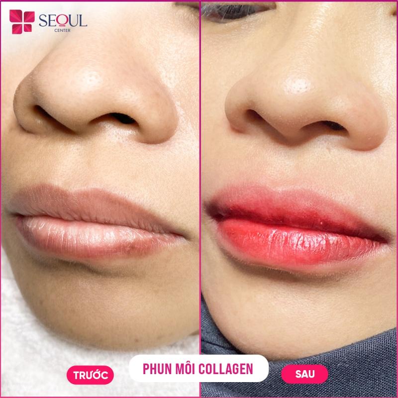 Thẩm Mỹ Seoul Center - Thiên Đường Làm Đẹp Tại Nha Trang