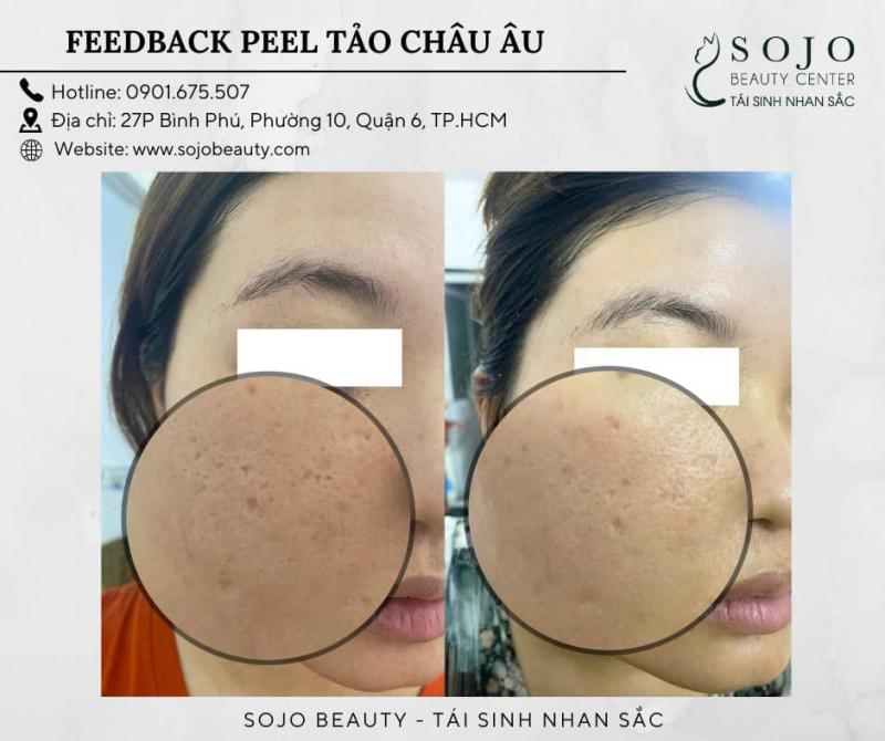 Thẩm Mỹ SOJO Beauty Center