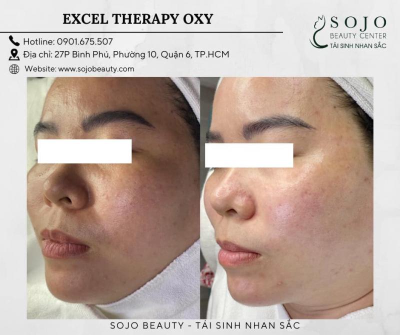 Thẩm Mỹ SOJO Beauty Center