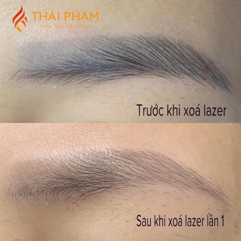 Thẩm mỹ Thái Phạm