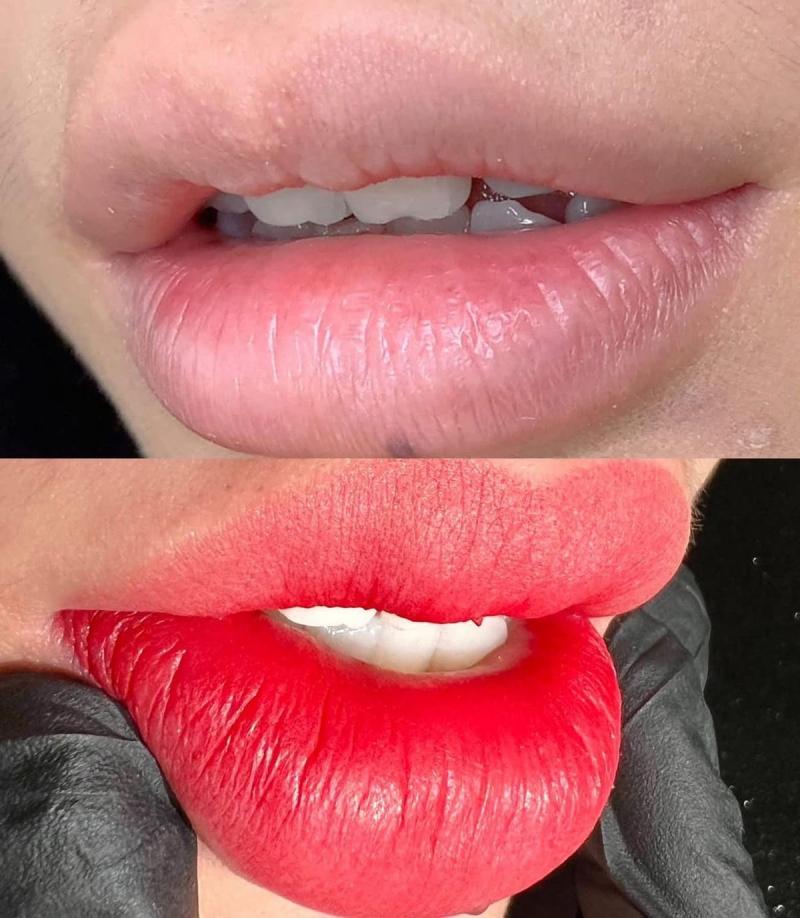 Thẩm mỹ Thắm Thỏ