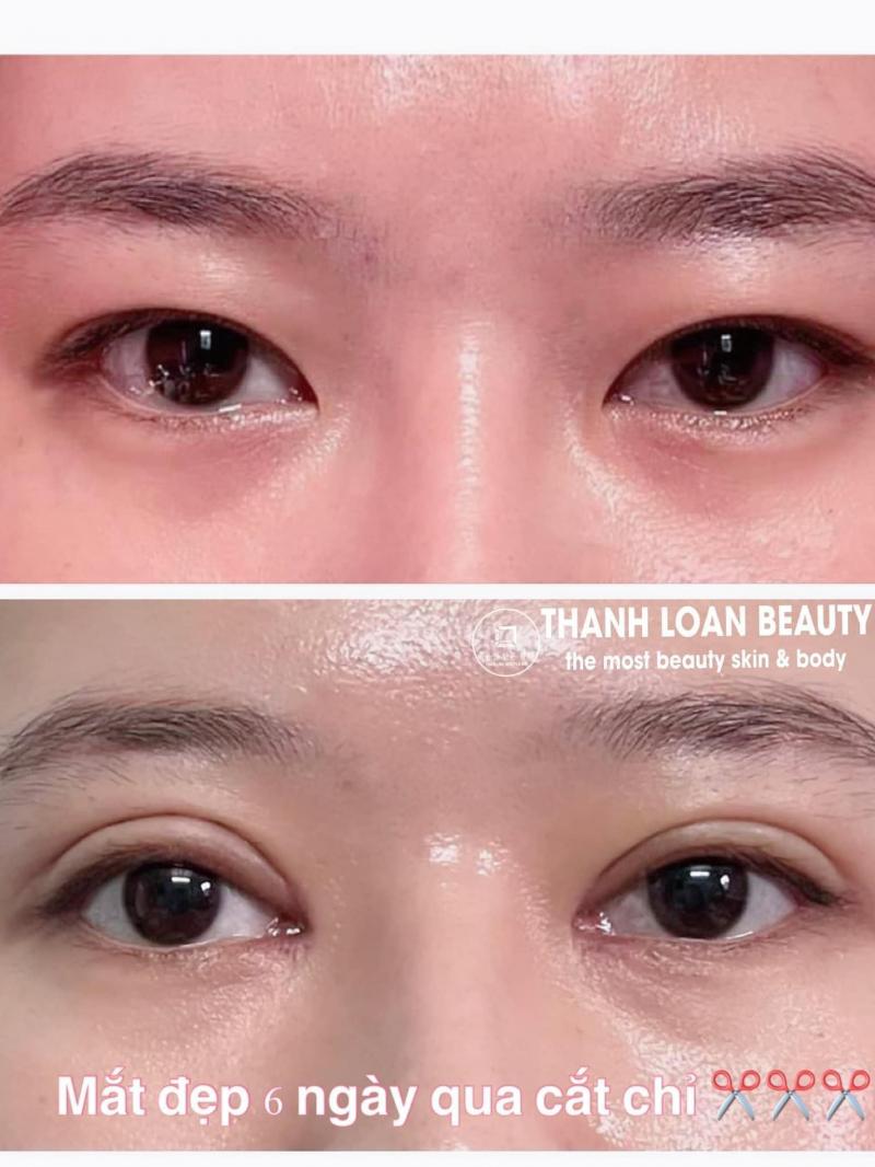 Thẩm Mỹ Thanh Loan Beauty Center