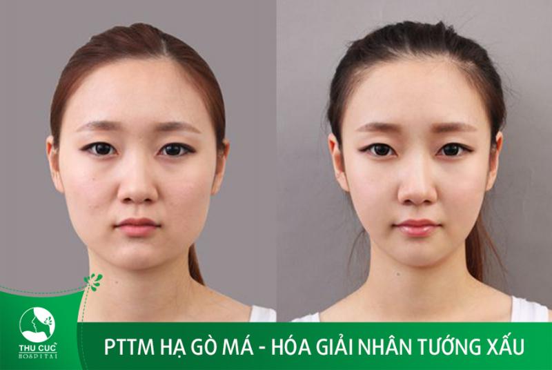 Thẩm mỹ Thu Cúc