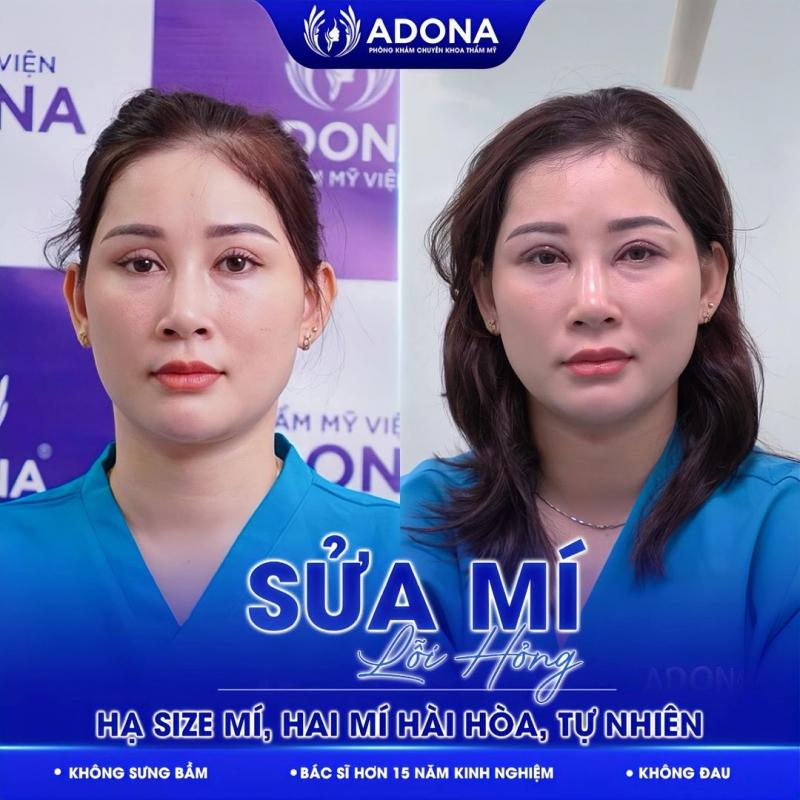 Thẩm Mỹ Viện Adona