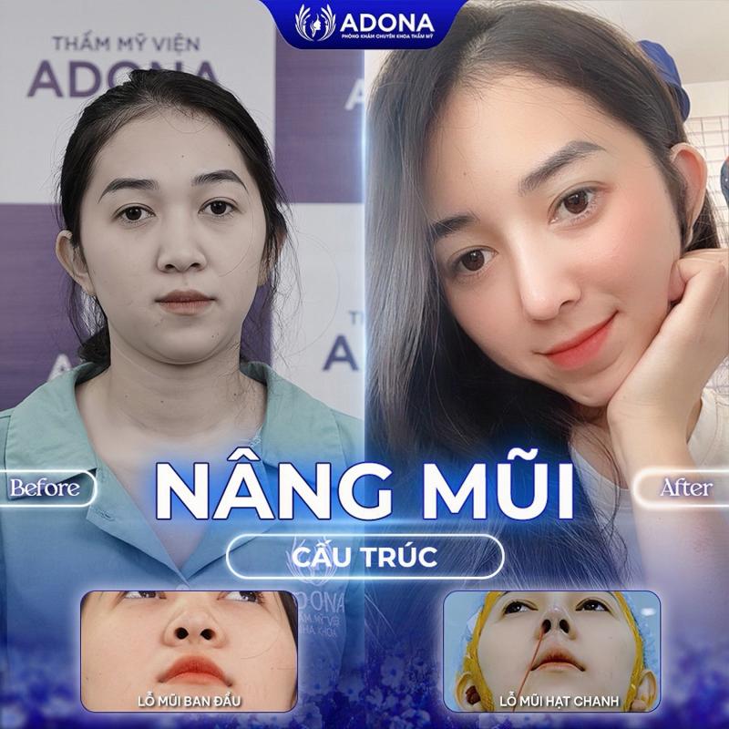 Thẩm Mỹ Viện Adona