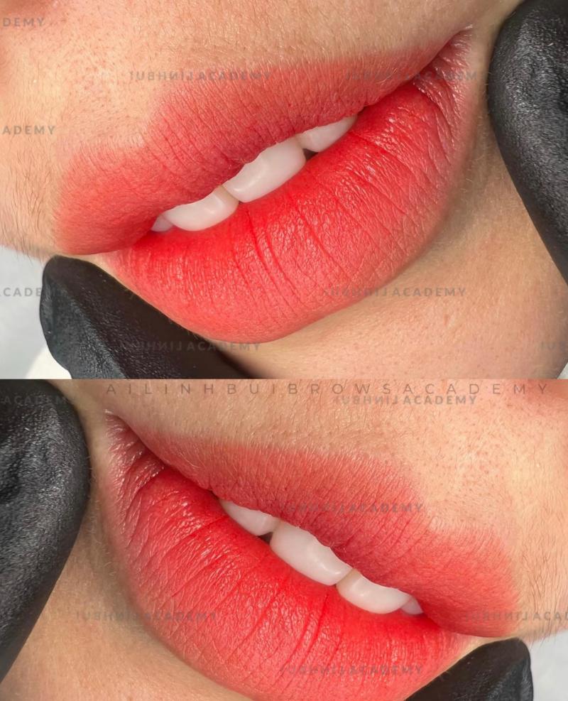 Thẩm mỹ viện Ái Linh Bùi