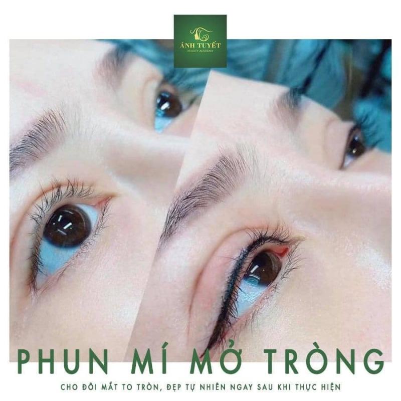 Thẩm Mỹ Viện Ánh Tuyết