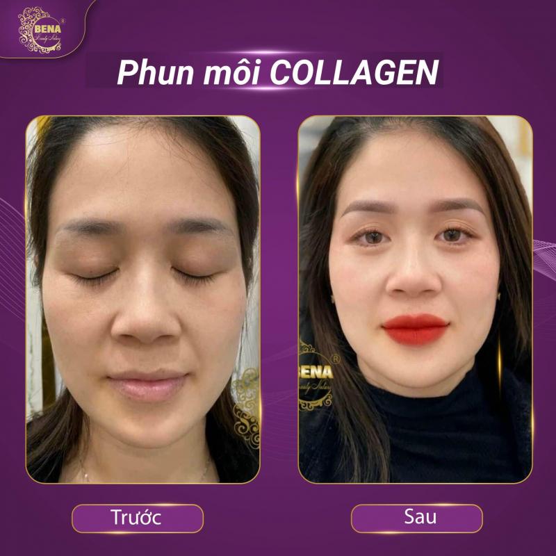 Thẩm Mỹ Viện Bena - Quảng Bình