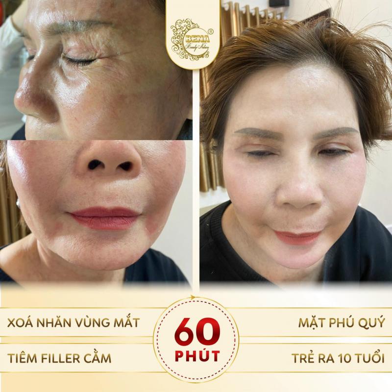 Thẩm Mỹ Viện BENA USA