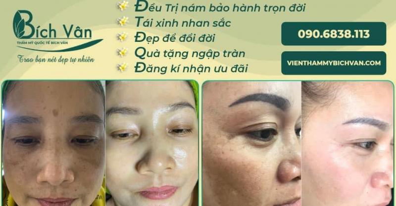 Thẩm Mỹ Viện Bích Vân giúp bạn tận hưởng những phút giây thư giãn cho tâm hồn và kéo dài nét rạng rỡ của tuổi xuân