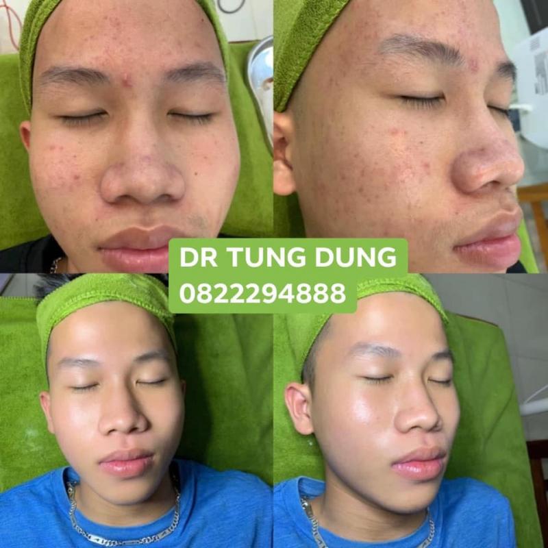 Thẩm Mỹ Viện BS Tùng Dung