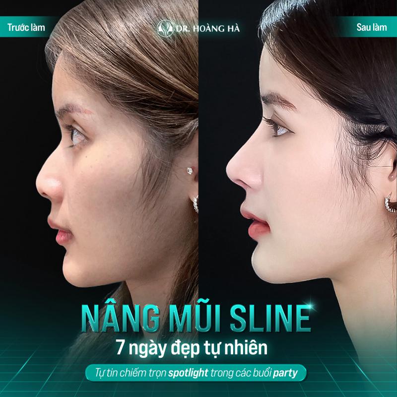 Thẩm mỹ viện Dr. Hoàng Hà