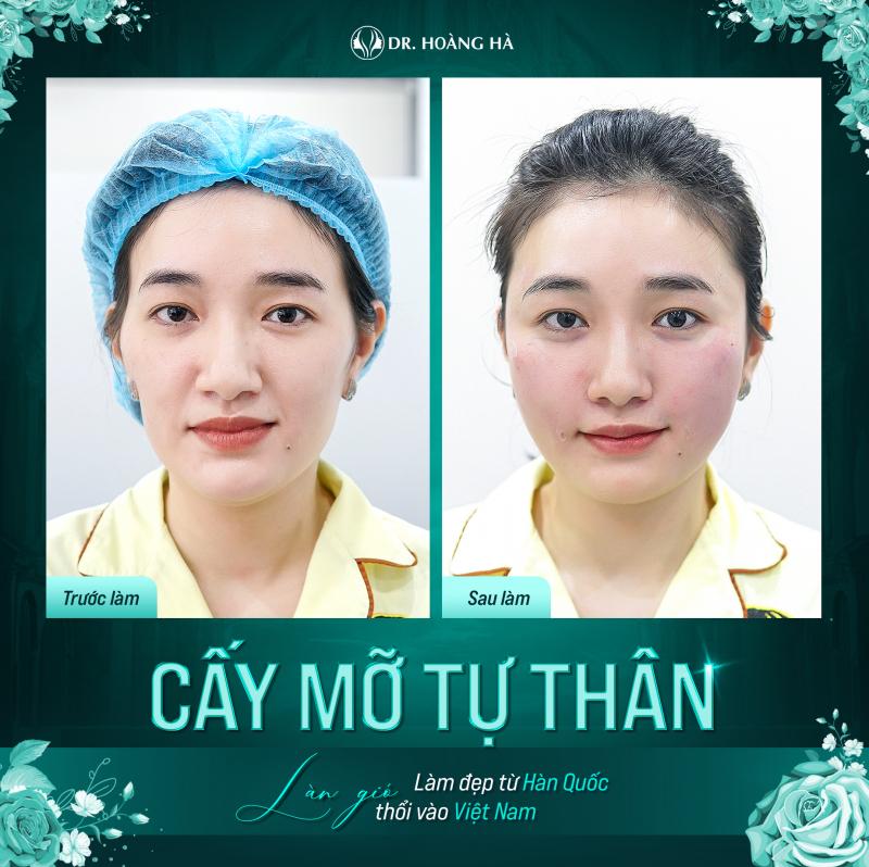 Thẩm mỹ viện Dr. Hoàng Hà