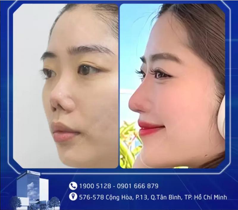 Thẩm mỹ viện GangWhoo Sài Gòn