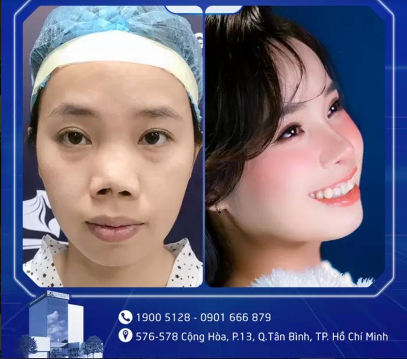 Thẩm mỹ viện GangWhoo Sài Gòn