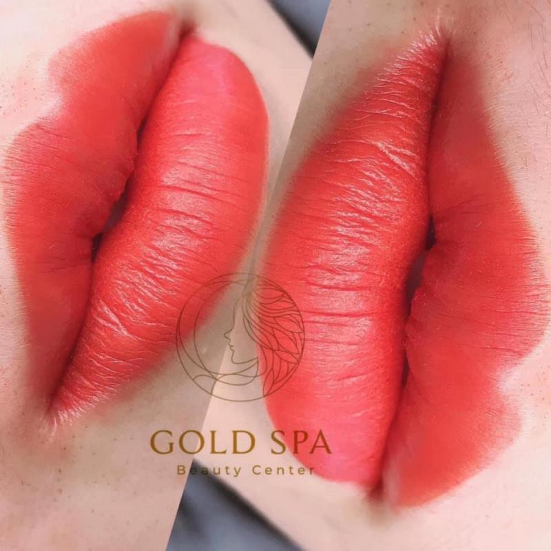 Thẩm mỹ viện Gold Spa