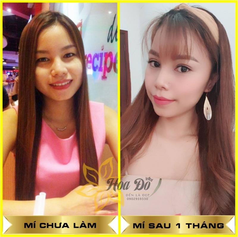 Thẩm Mỹ Viện Hoa Đô - Đến Là Đẹp