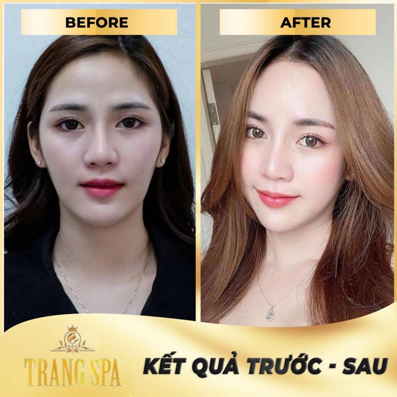 Thẩm Mỹ viện Hoa Hậu Hà Thu Trang