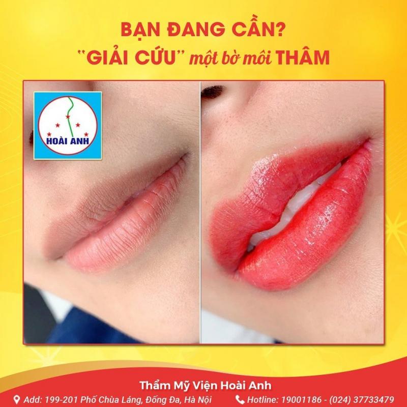 Thẩm mỹ viện Hoài Anh