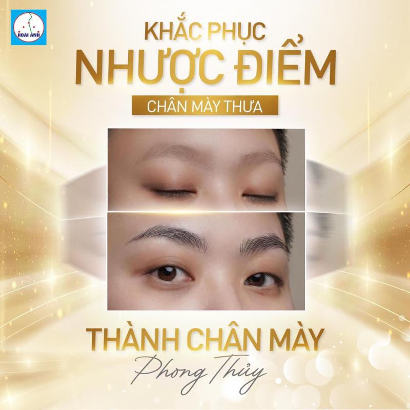 Thẩm mỹ viện Hoài Anh