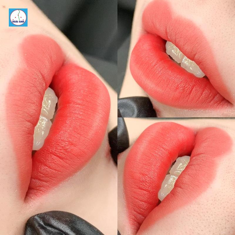 Thẩm mỹ viện Hoài Anh