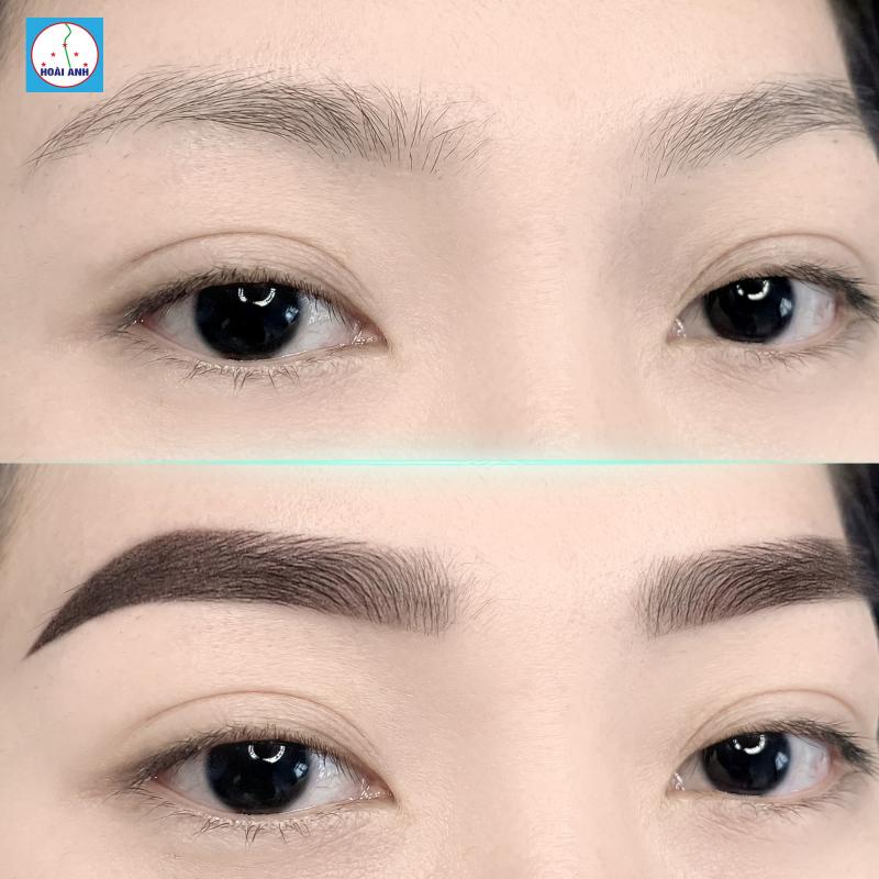 Thẩm mỹ viện Hoài Anh