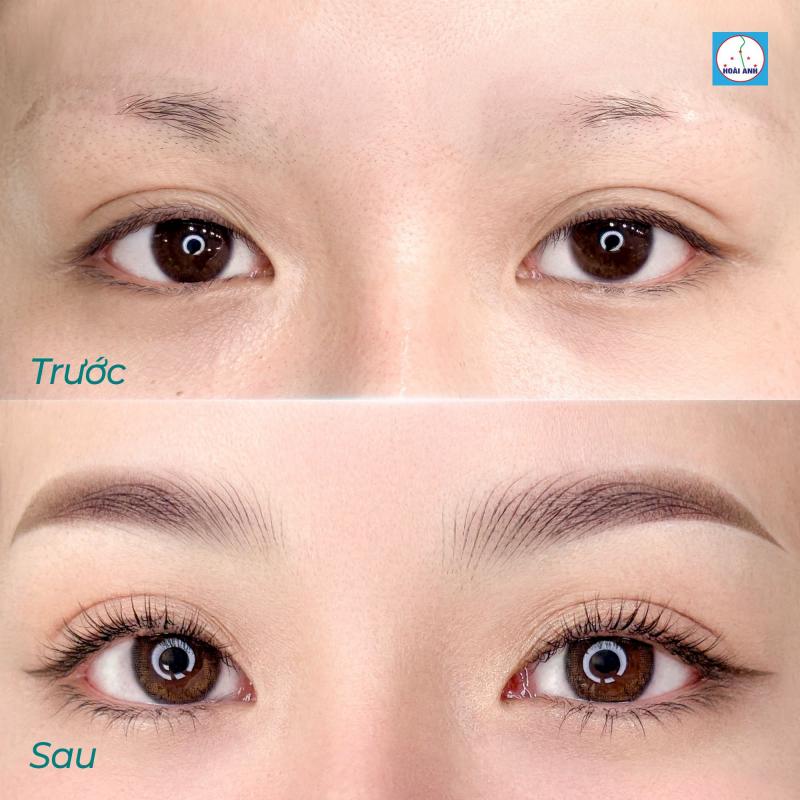 Thẩm mỹ viện Hoài Anh