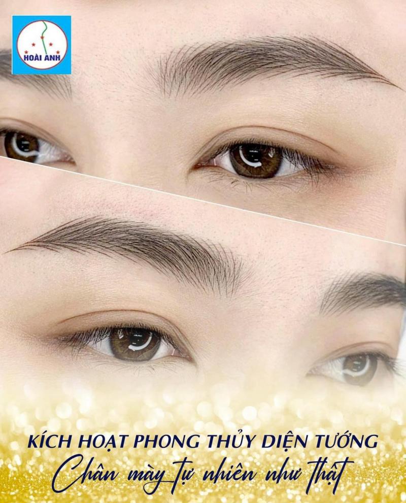 Thẩm mỹ viện Hoài Anh CN Quận 5